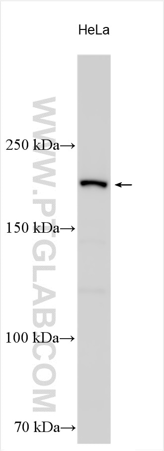 Western Blot (WB) analysis of various lysates using ZNFX1 Polyclonal antibody (55381-1-AP)