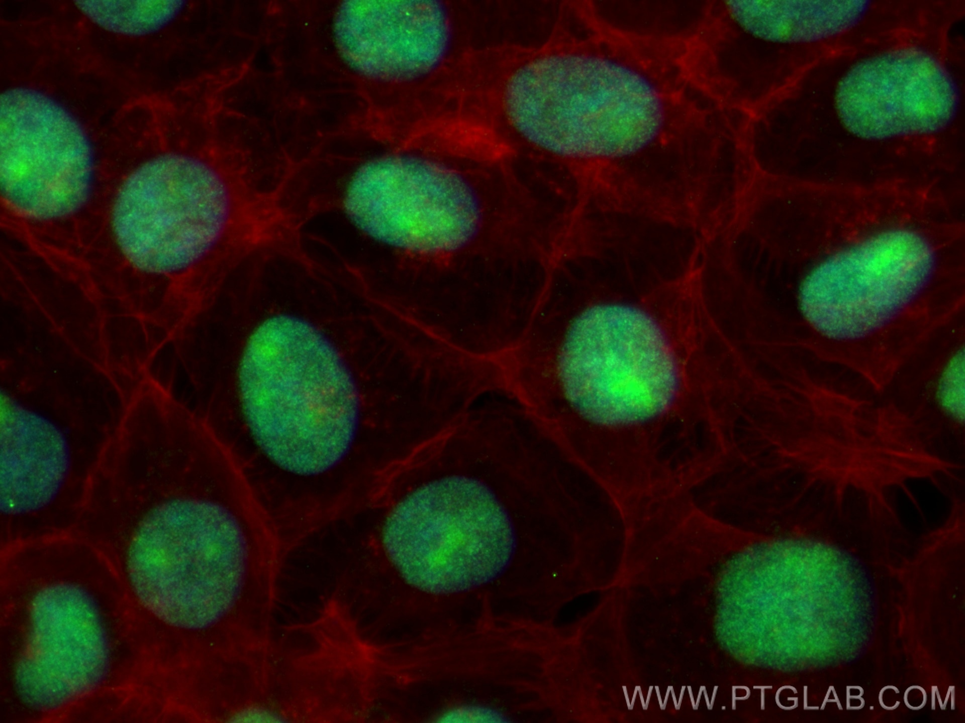 Immunofluorescence (IF) / fluorescent staining of A431 cells using ZNHIT1 Polyclonal antibody (16595-1-AP)