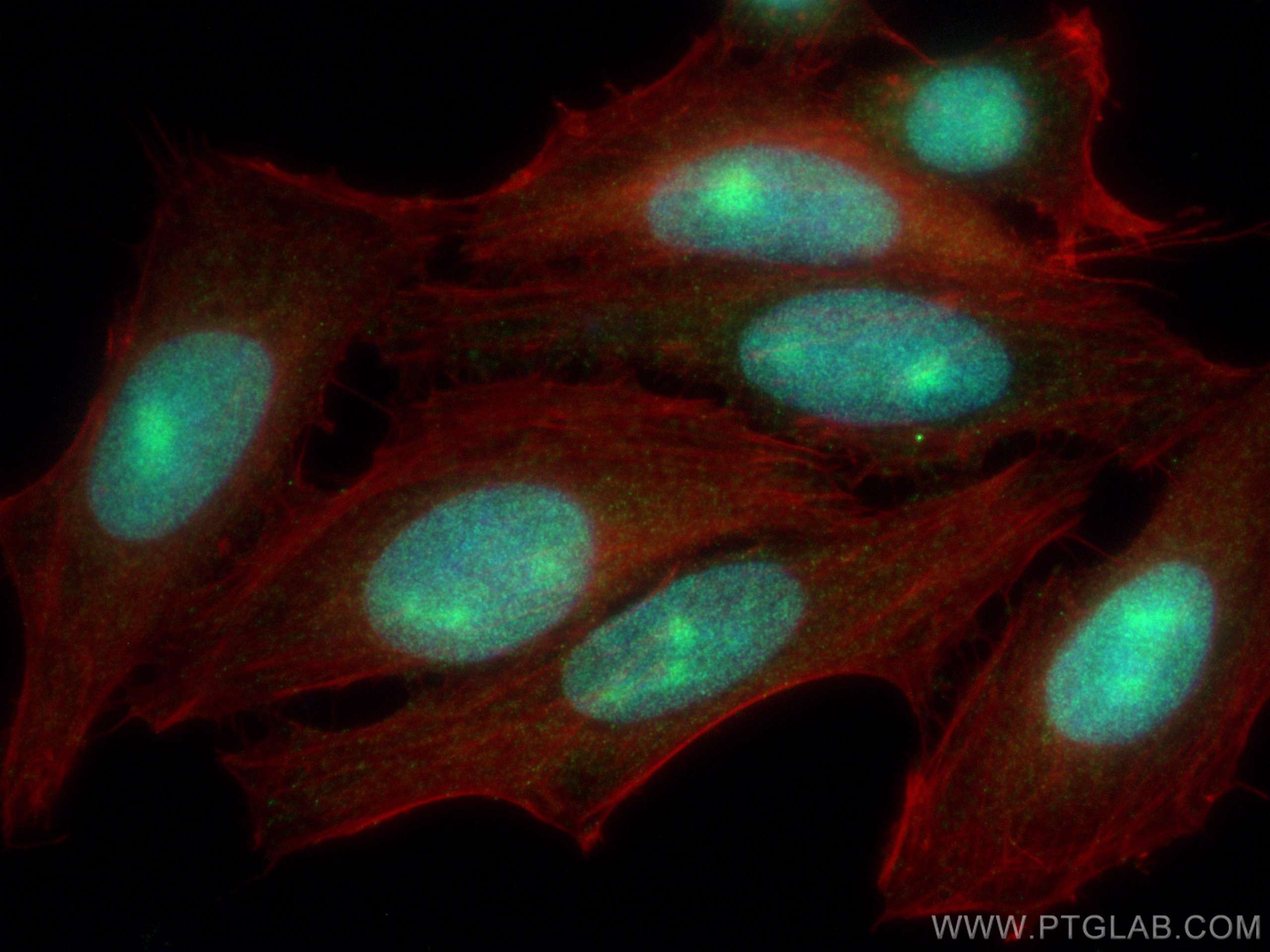 Immunofluorescence (IF) / fluorescent staining of HepG2 cells using ZNHIT1 Polyclonal antibody (16595-1-AP)