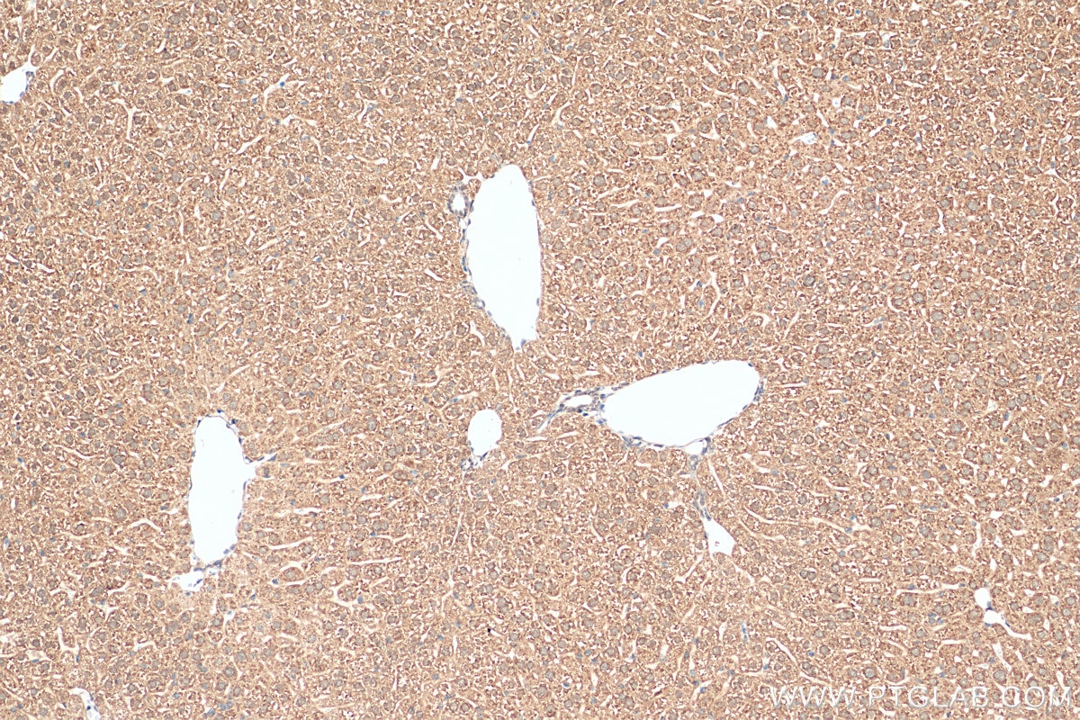 Immunohistochemistry (IHC) staining of mouse liver tissue using ZNHIT1 Polyclonal antibody (16595-1-AP)