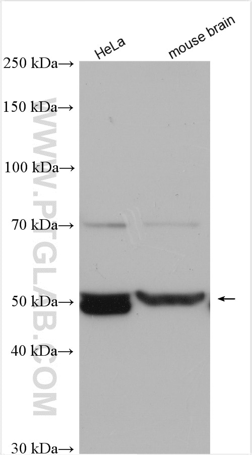 Western Blot (WB) analysis of various lysates using ZNHIT2 Polyclonal antibody (16885-1-AP)