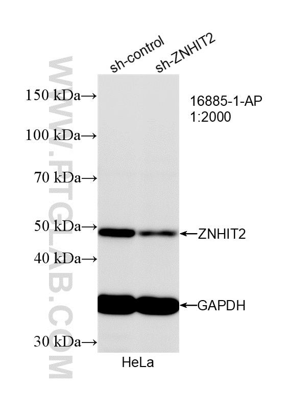 WB result of ZNHIT2 antibody (16885-1-AP; 1:2000; incubated at room temperature for 1.5 hours) with sh-Control and sh-ZNHIT2 transfected HeLa cells. Western Blot (WB) analysis of HeLa cells using ZNHIT2 Polyclonal antibody (16885-1-AP)