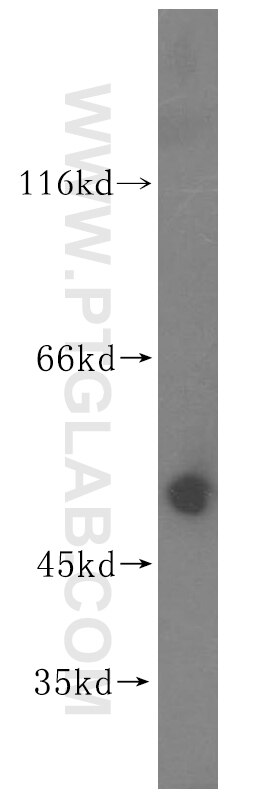 Western Blot (WB) analysis of human brain tissue using ZNHIT2 Polyclonal antibody (16885-1-AP)