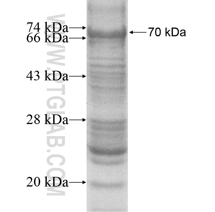ZNHIT2 fusion protein Ag10351 SDS-PAGE