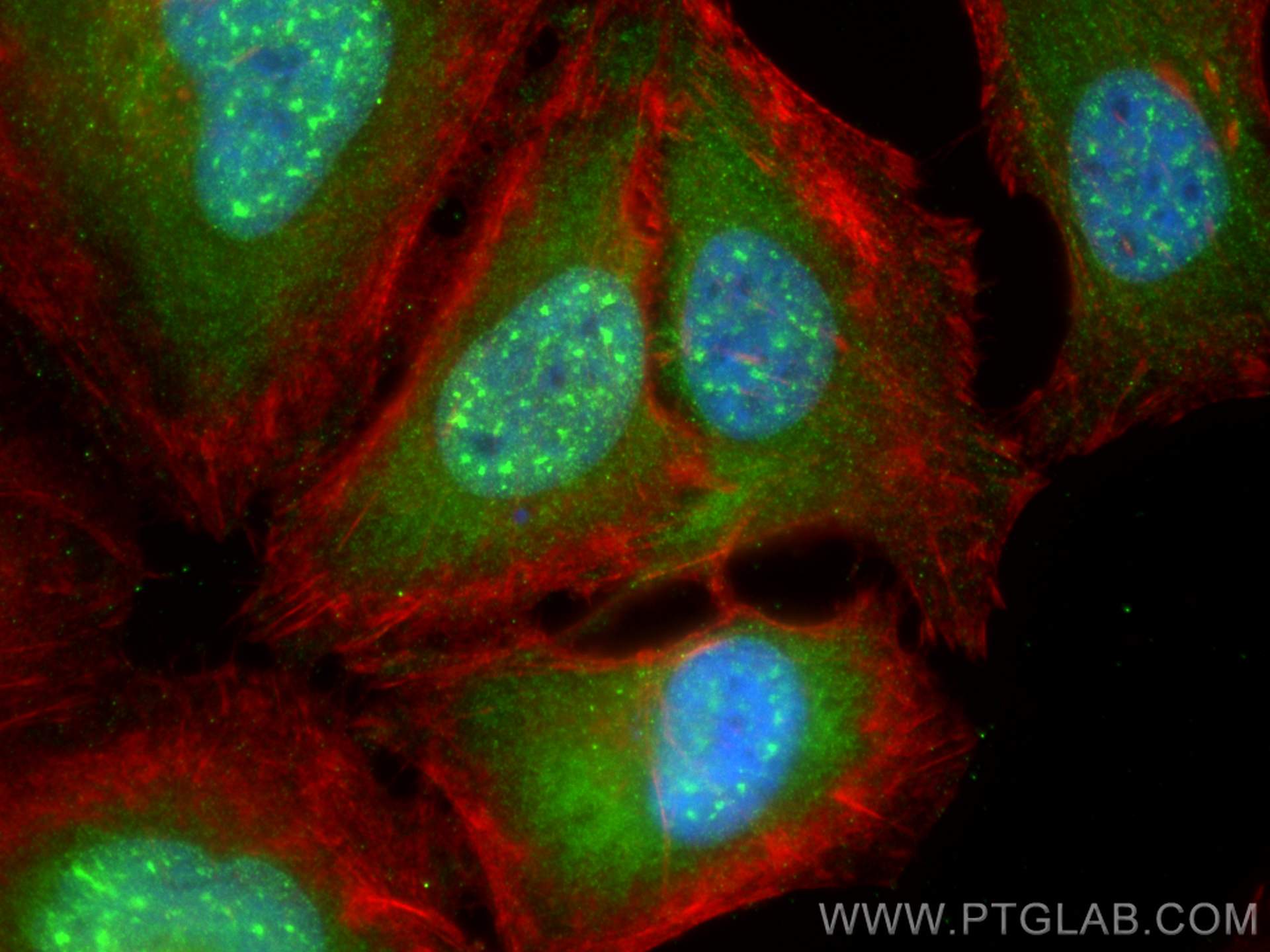 Immunofluorescence (IF) / fluorescent staining of HeLa cells using ZNHIT3 Monoclonal antibody (68331-1-Ig)