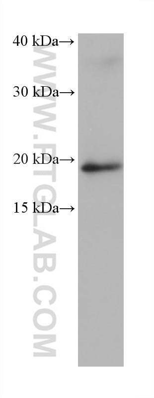 Western Blot (WB) analysis of hTERT-RPE1 cells using ZNHIT3 Monoclonal antibody (68331-1-Ig)