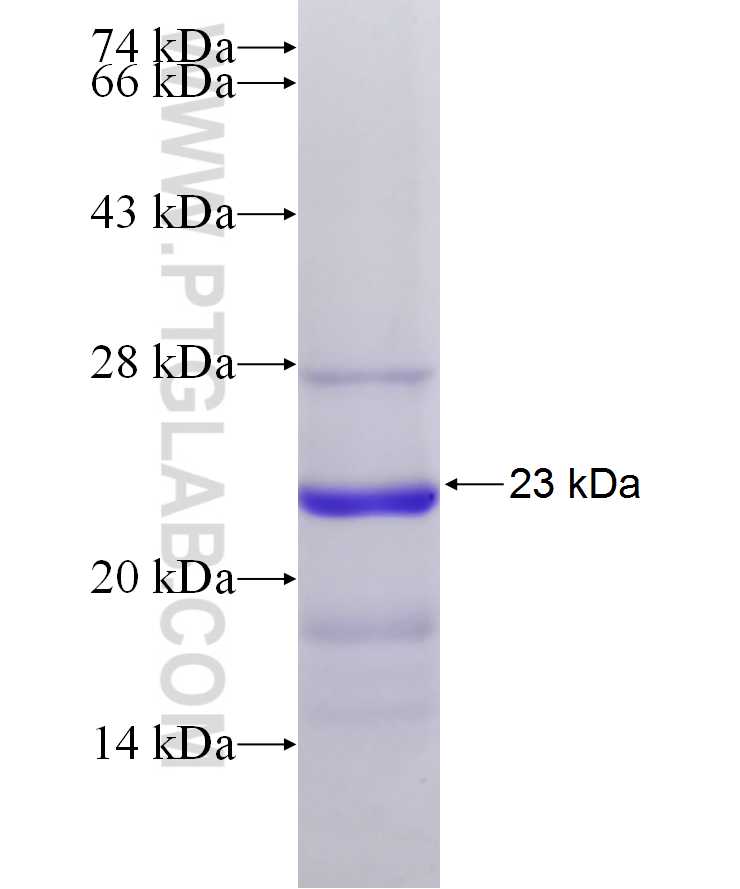 ZNHIT3 fusion protein Ag29872 SDS-PAGE