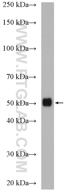 Western Blot (WB) analysis of mouse lung tissue using ZNHIT6 Polyclonal antibody (28019-1-AP)