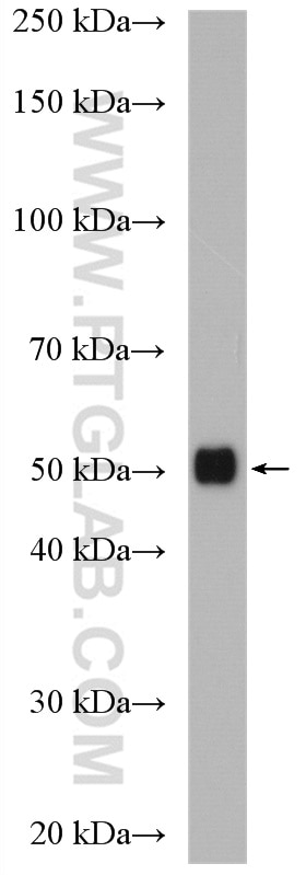 WB analysis of mouse lung using 28019-1-AP