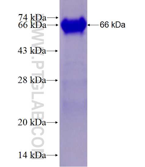 ZNHIT6 fusion protein Ag27792 SDS-PAGE