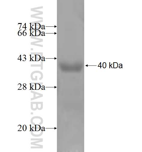 ZNRD1 fusion protein Ag5749 SDS-PAGE