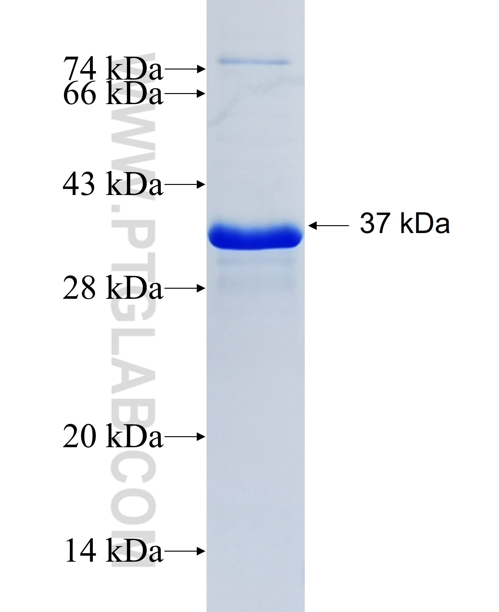 ZNRD1 fusion protein Ag5749 SDS-PAGE