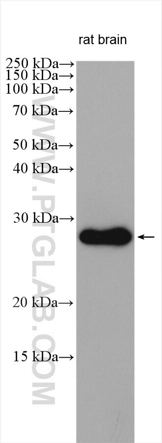 Western Blot (WB) analysis of various lysates using ZNRF2-Specific Polyclonal antibody (20200-1-AP)