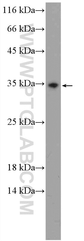 Western Blot (WB) analysis of mouse brain tissue using ZNRF2-Specific Polyclonal antibody (20200-1-AP)