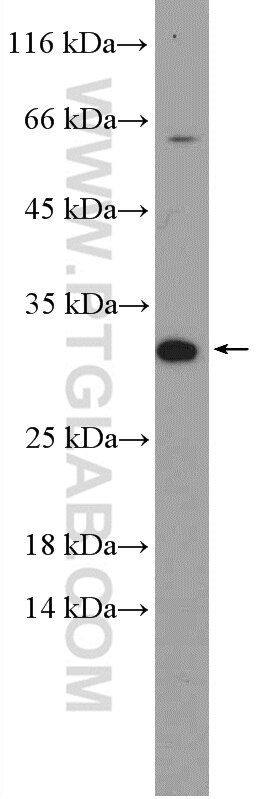 Western Blot (WB) analysis of mouse testis tissue using ZNRF2-Specific Polyclonal antibody (20200-1-AP)