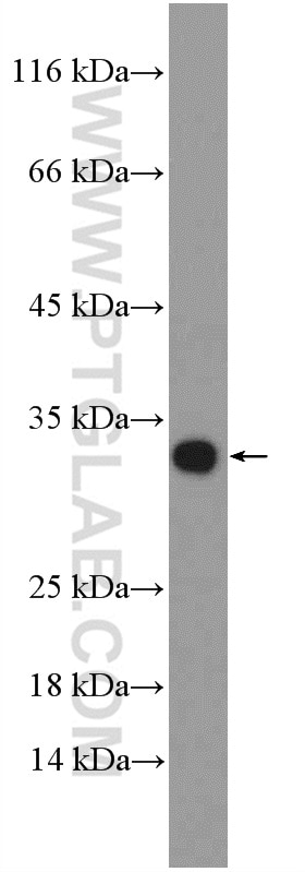 Western Blot (WB) analysis of mouse kidney tissue using ZNRF2-Specific Polyclonal antibody (20200-1-AP)