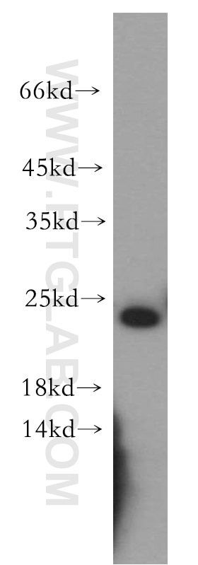 WB analysis of mouse kidney using 20200-1-AP