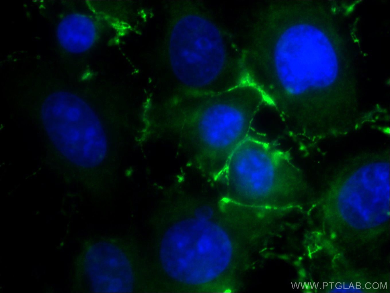 Immunofluorescence (IF) / fluorescent staining of HUVEC cells using ZO-1 Polyclonal antibody (20742-1-AP)