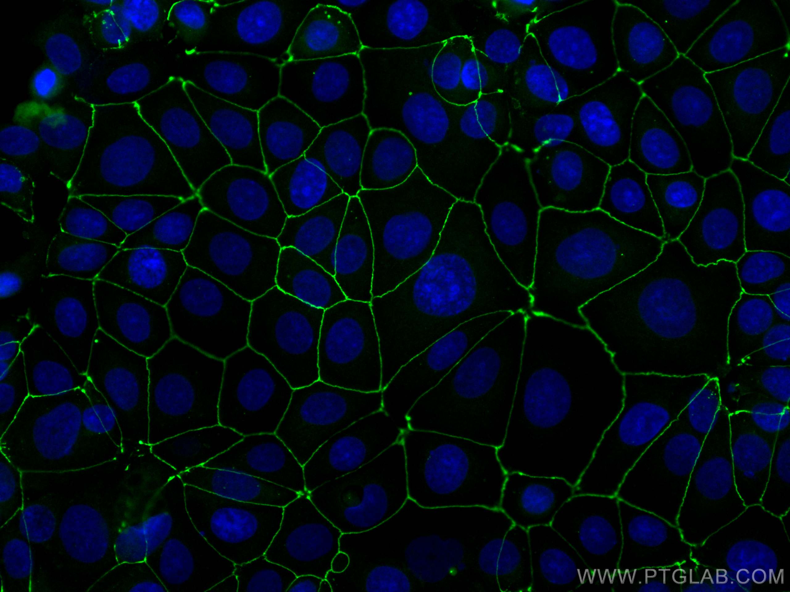 Immunofluorescence (IF) / fluorescent staining of MCF-7 cells using CoraLite® Plus 488-conjugated ZO-1 Polyclonal anti (CL488-21773)