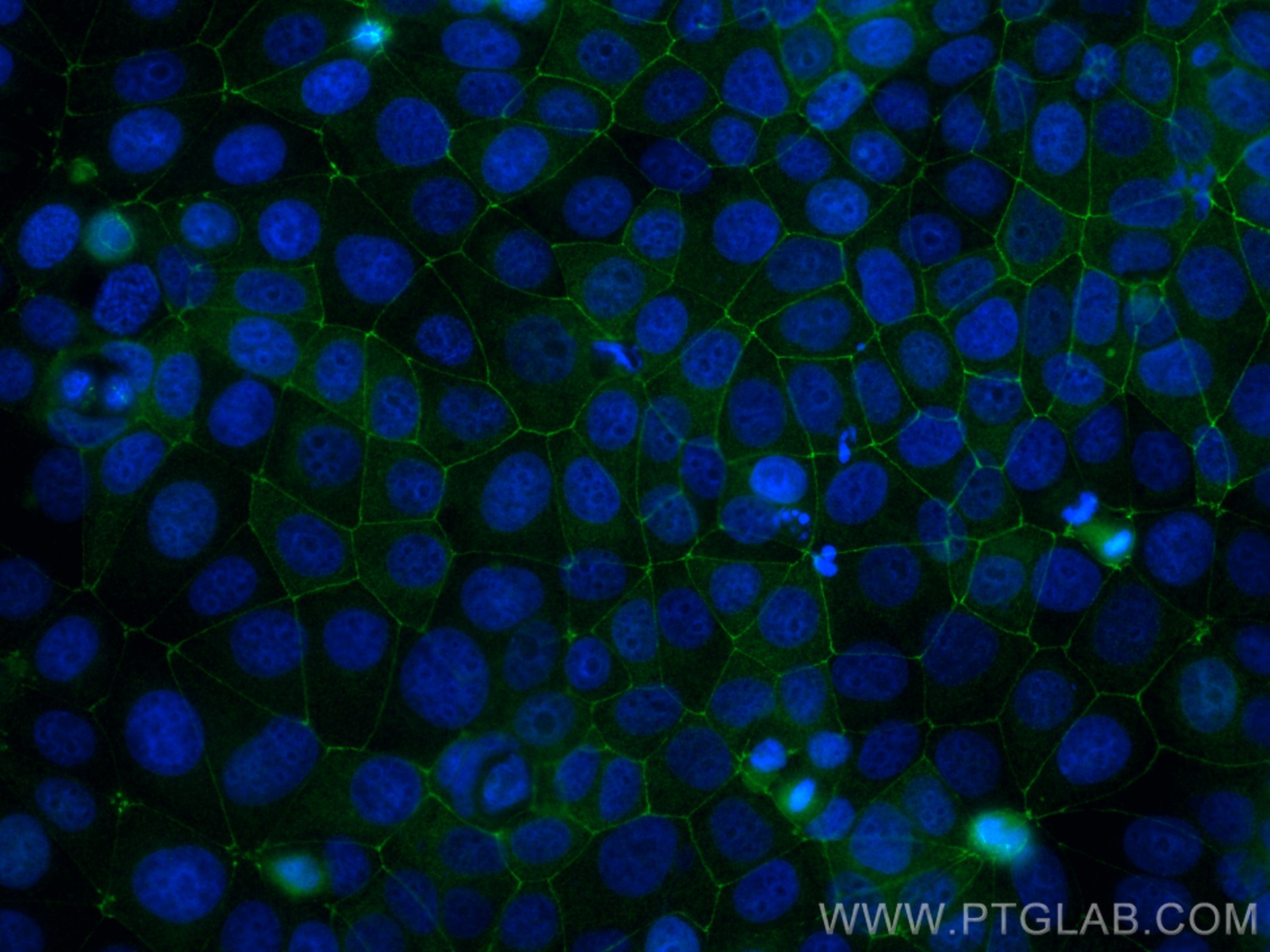 Immunofluorescence (IF) / fluorescent staining of MCF-7 cells using CoraLite® Plus 488-conjugated ZO-1 Monoclonal anti (CL488-66452)