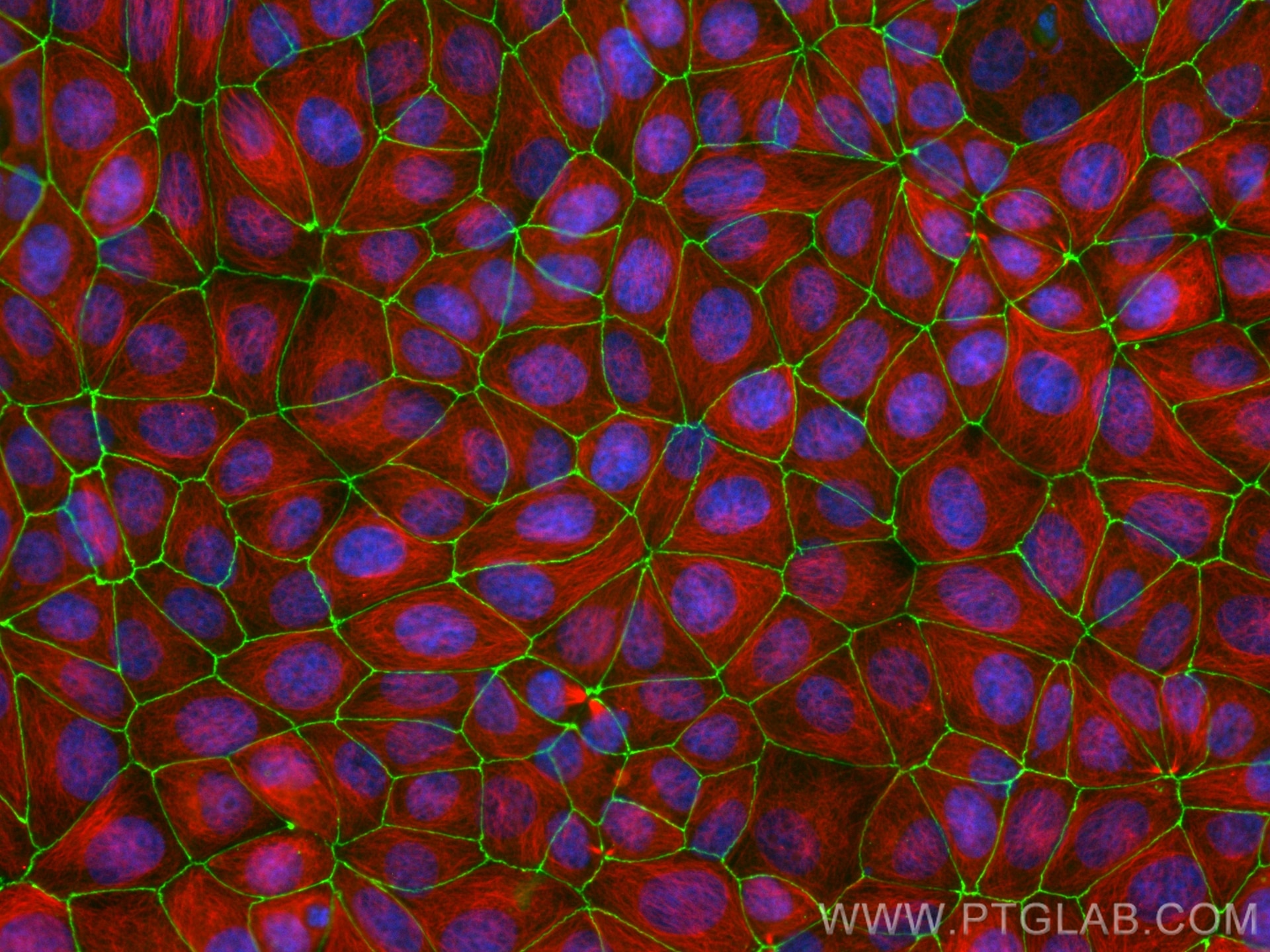 Immunofluorescence (IF) / fluorescent staining of MCF-7 cells using CoraLite® Plus 488-conjugated ZO-1 Recombinant ant (CL488-82870-7)