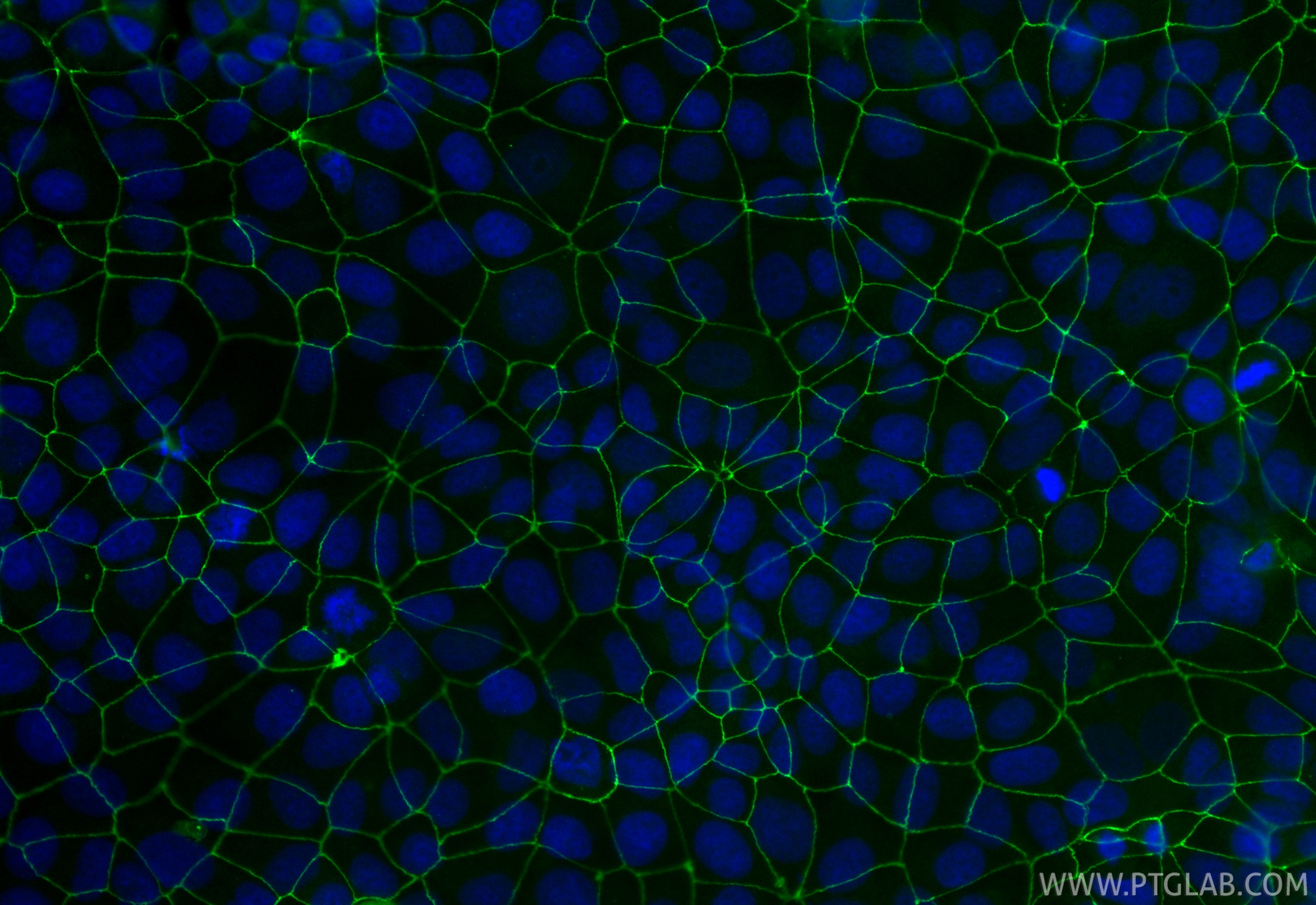 IF Staining of MCF-7 using CL488-82870-7 Immunofluorescence (IF) / fluorescent staining of MCF-7 cells using CoraLite® Plus 488-conjugated ZO-1 Recombinant mon (CL488-82870-7)