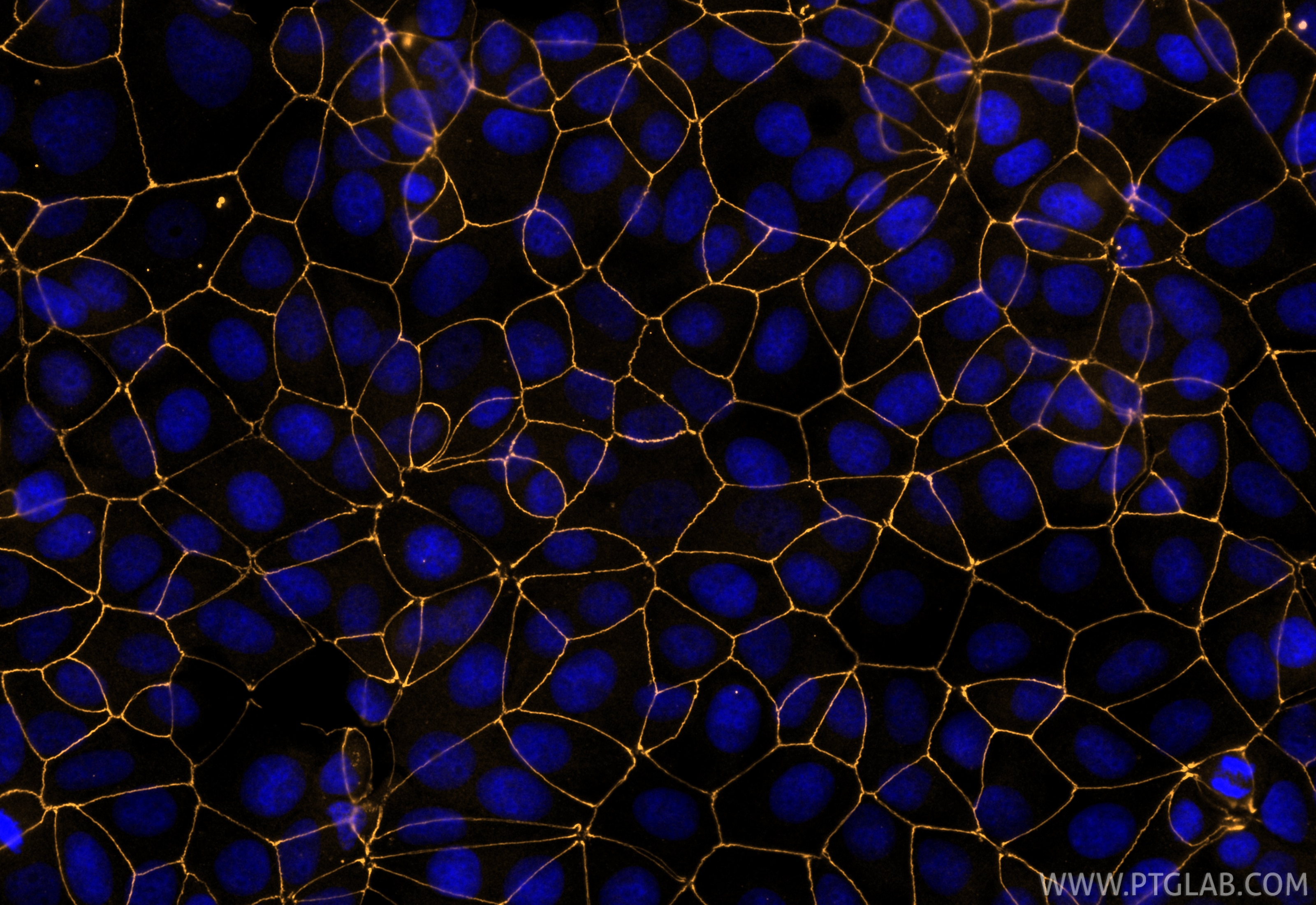 Immunofluorescence (IF) / fluorescent staining of MCF-7 cells using CoraLite® Plus 555-conjugated ZO-1 Recombinant mon (CL555-82870-7)