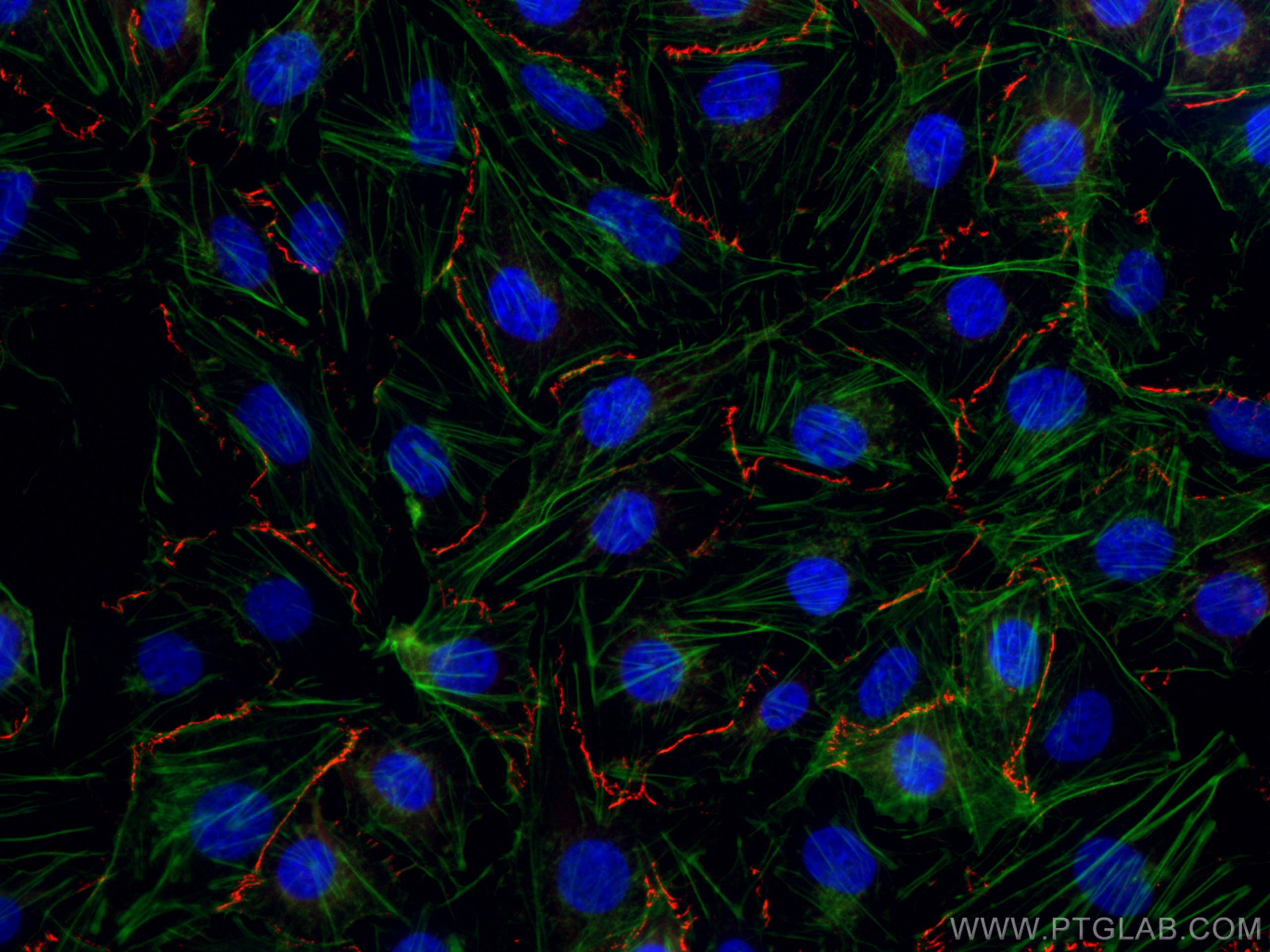 IF Staining of HUVEC using CL594-21773