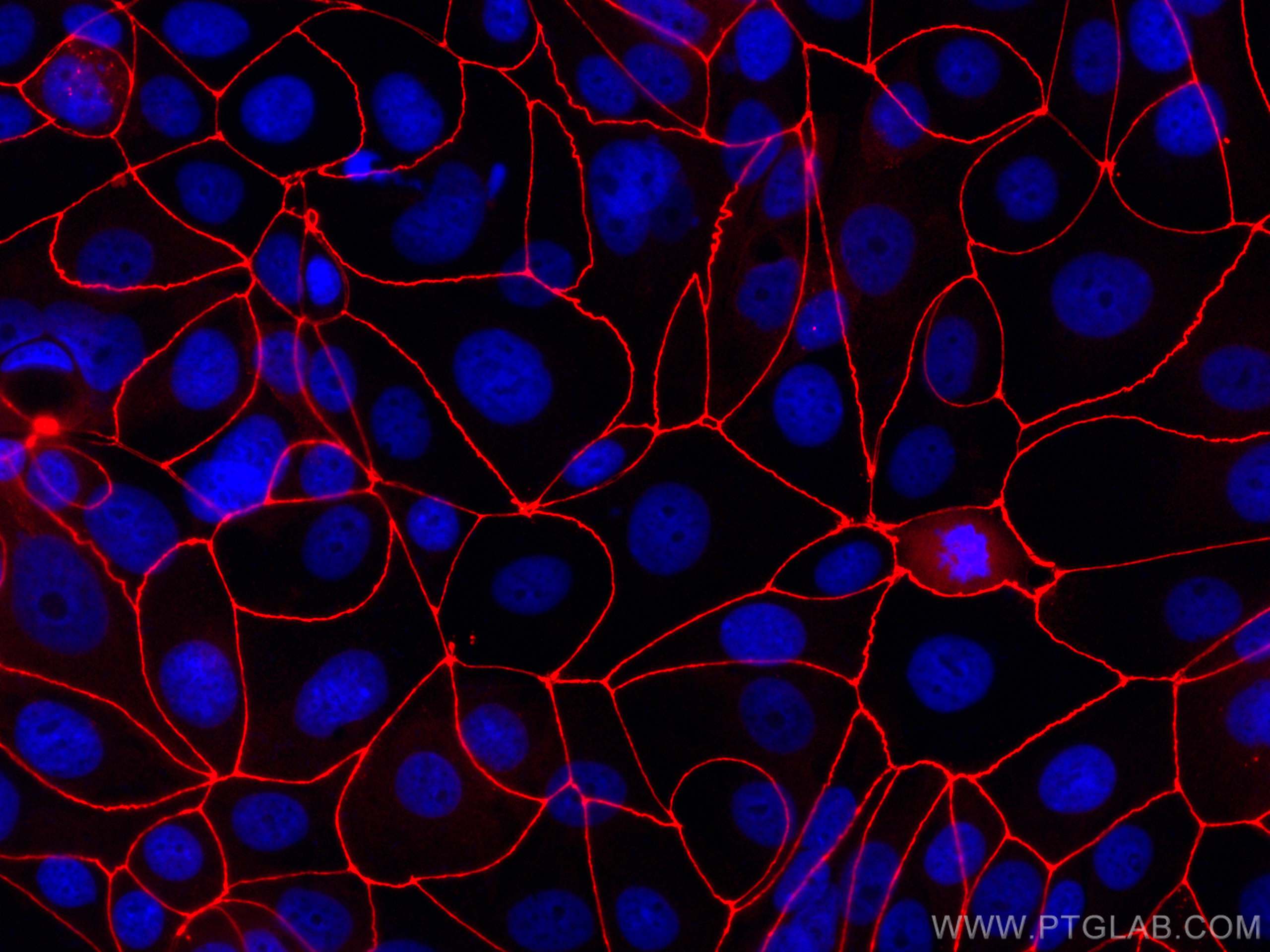 Immunofluorescence (IF) / fluorescent staining of MCF-7 cells using CoraLite®594-conjugated ZO-1 Polyclonal antibody (CL594-21773)