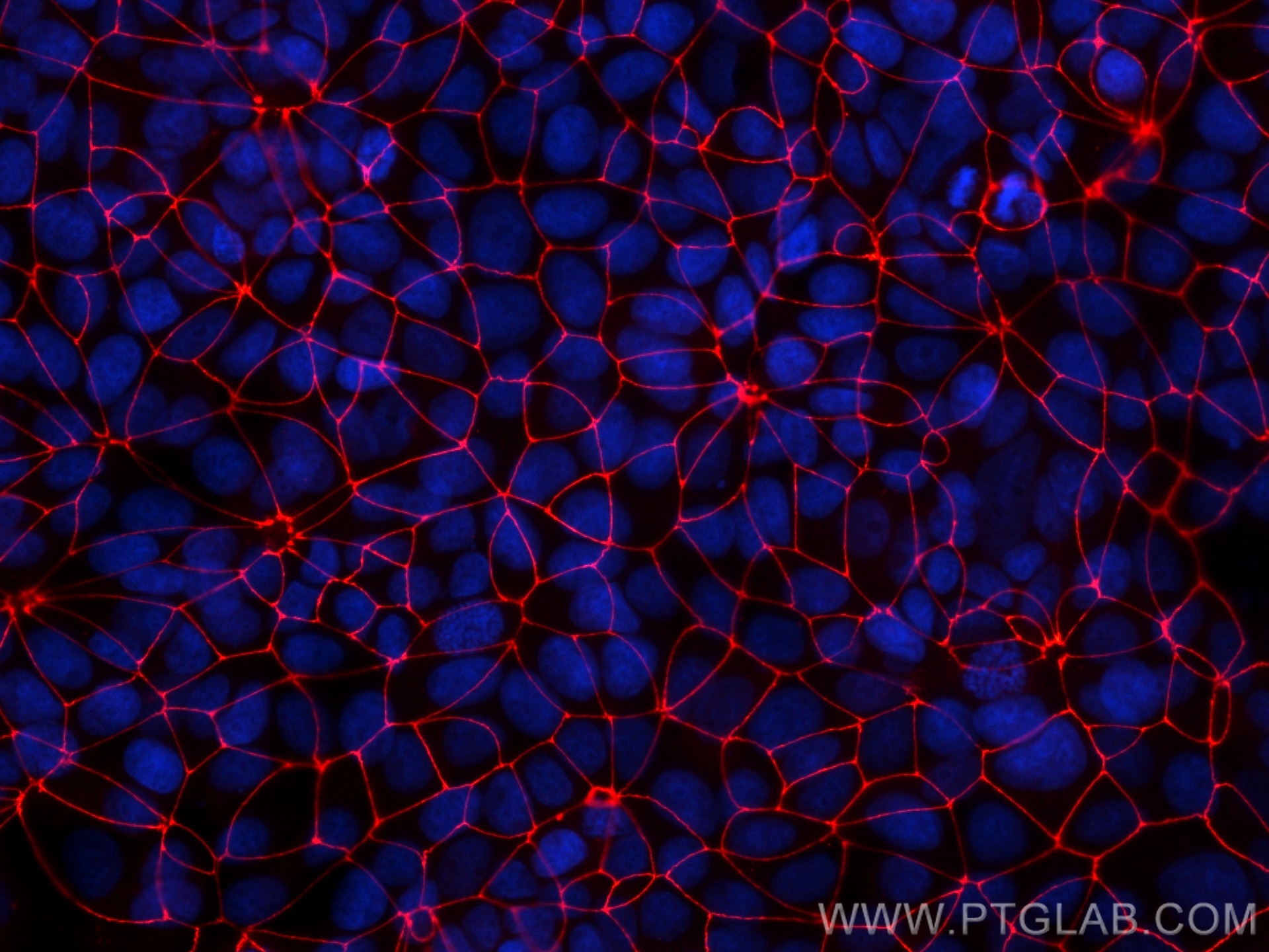 Immunofluorescence (IF) / fluorescent staining of MCF-7 cells using CoraLite®594-conjugated ZO-1 Recombinant antibody (CL594-82870-7)