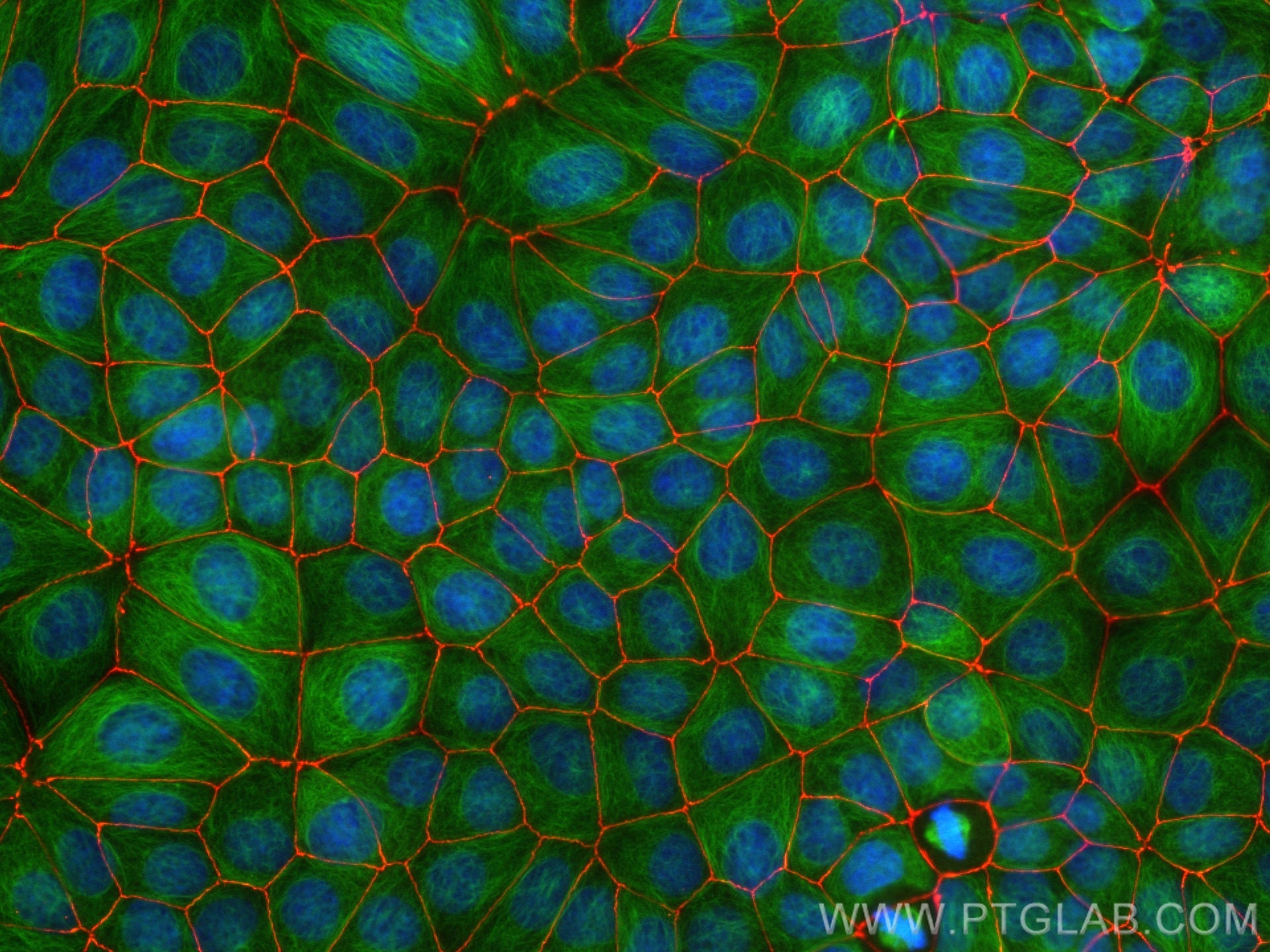 Immunofluorescence (IF) / fluorescent staining of MCF-7 cells using CoraLite®594-conjugated ZO-1 Recombinant antibody (CL594-82870-7)