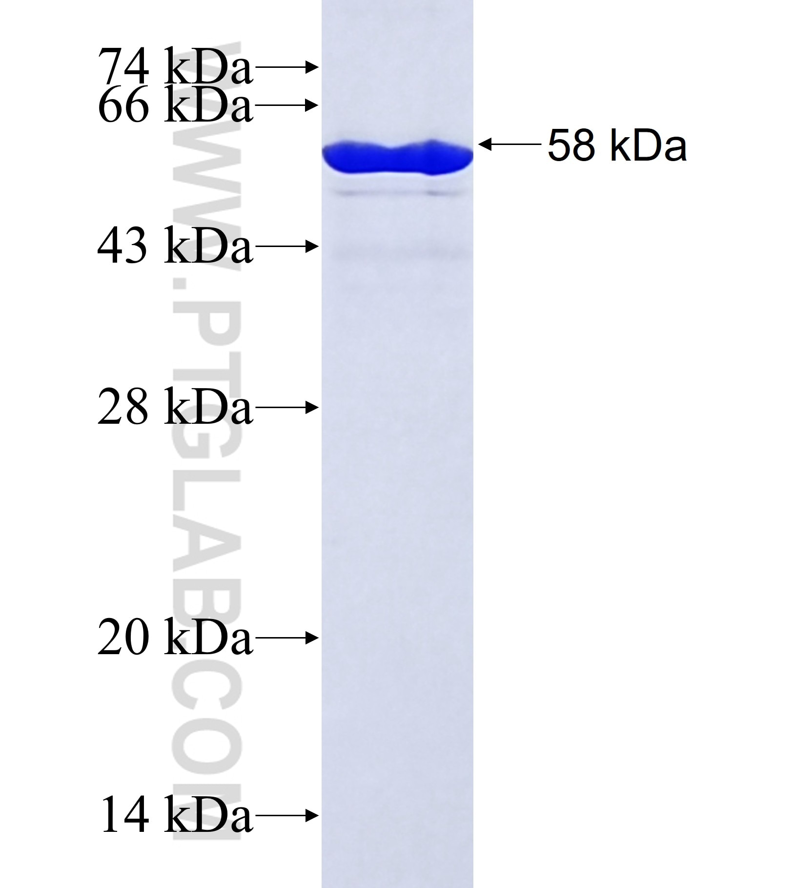 ZO-1 fusion protein Ag42022 SDS-PAGE ZO-1 fusion protein Ag42022 SDS-PAGE