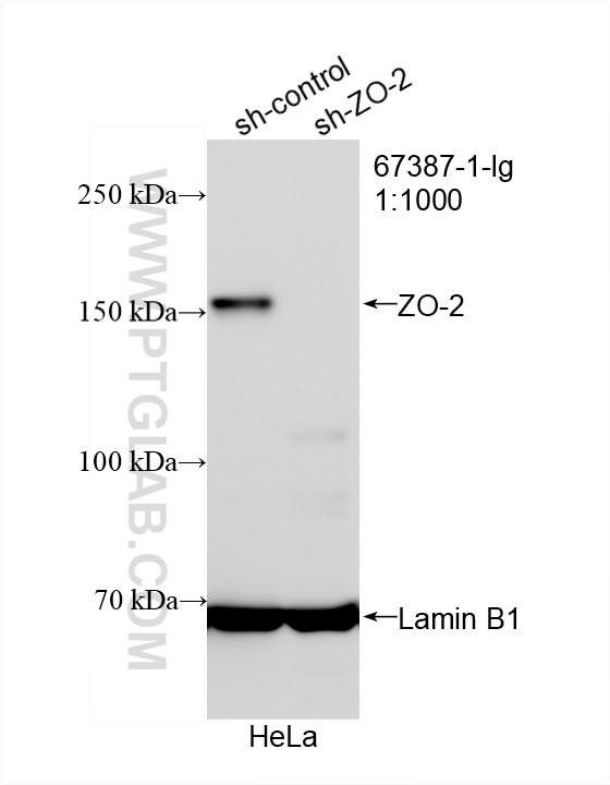 WB analysis of HeLa using 67387-1-Ig