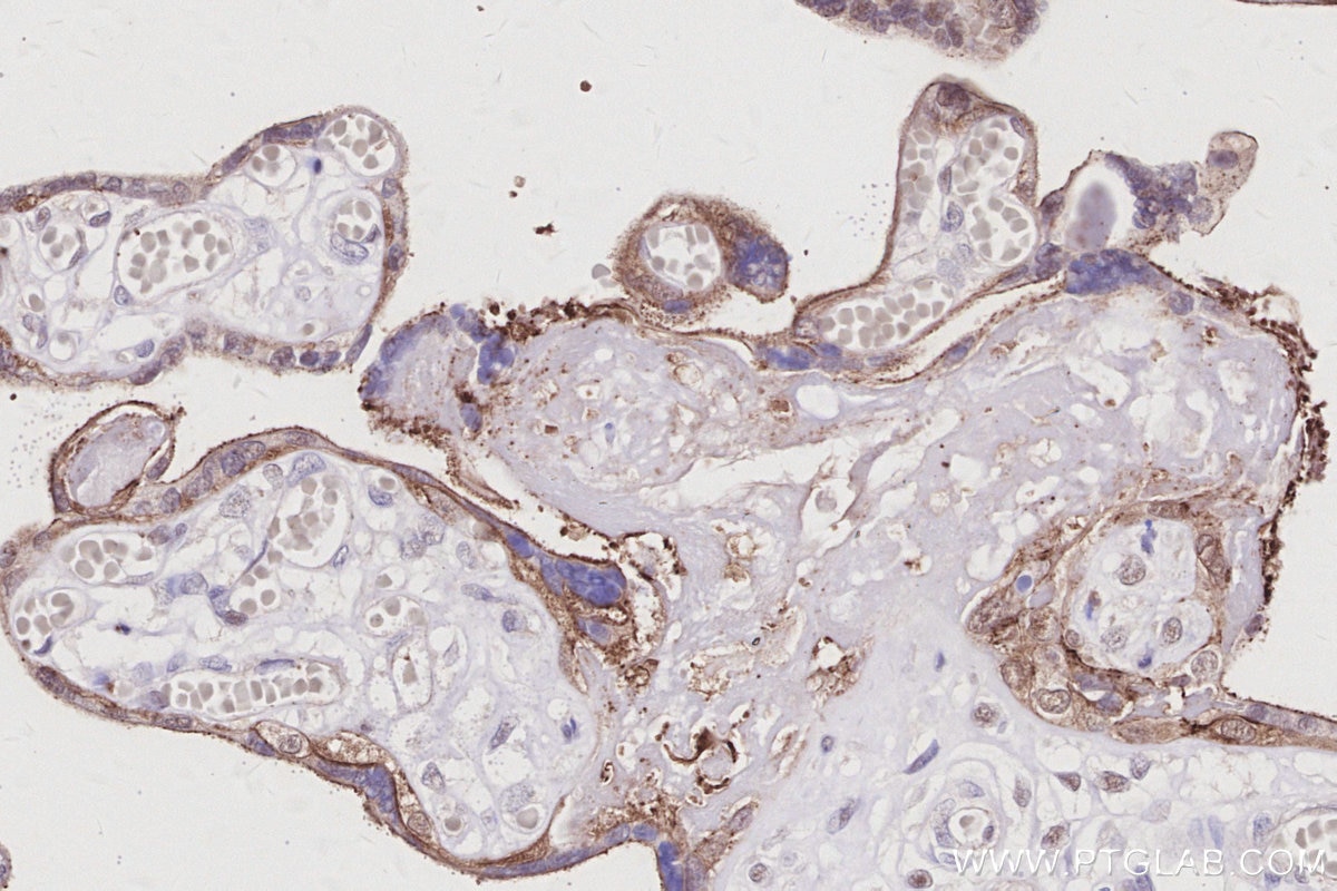 IHC staining of human placenta using 83111-4-RR Immunohistochemistry (IHC) staining of human placenta tissue using ZO-2 Recombinant monoclonal antibody (83111-4-RR)