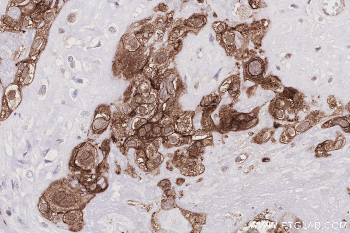 IHC staining of human placenta using 83111-4-RR Immunohistochemistry (IHC) staining of human placenta tissue using ZO-2 Recombinant monoclonal antibody (83111-4-RR)
