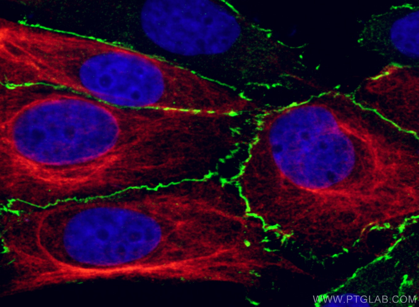Immunofluorescence (IF) / fluorescent staining of MDCK cells using ZO-1 Polyclonal antibody (21773-1-AP)