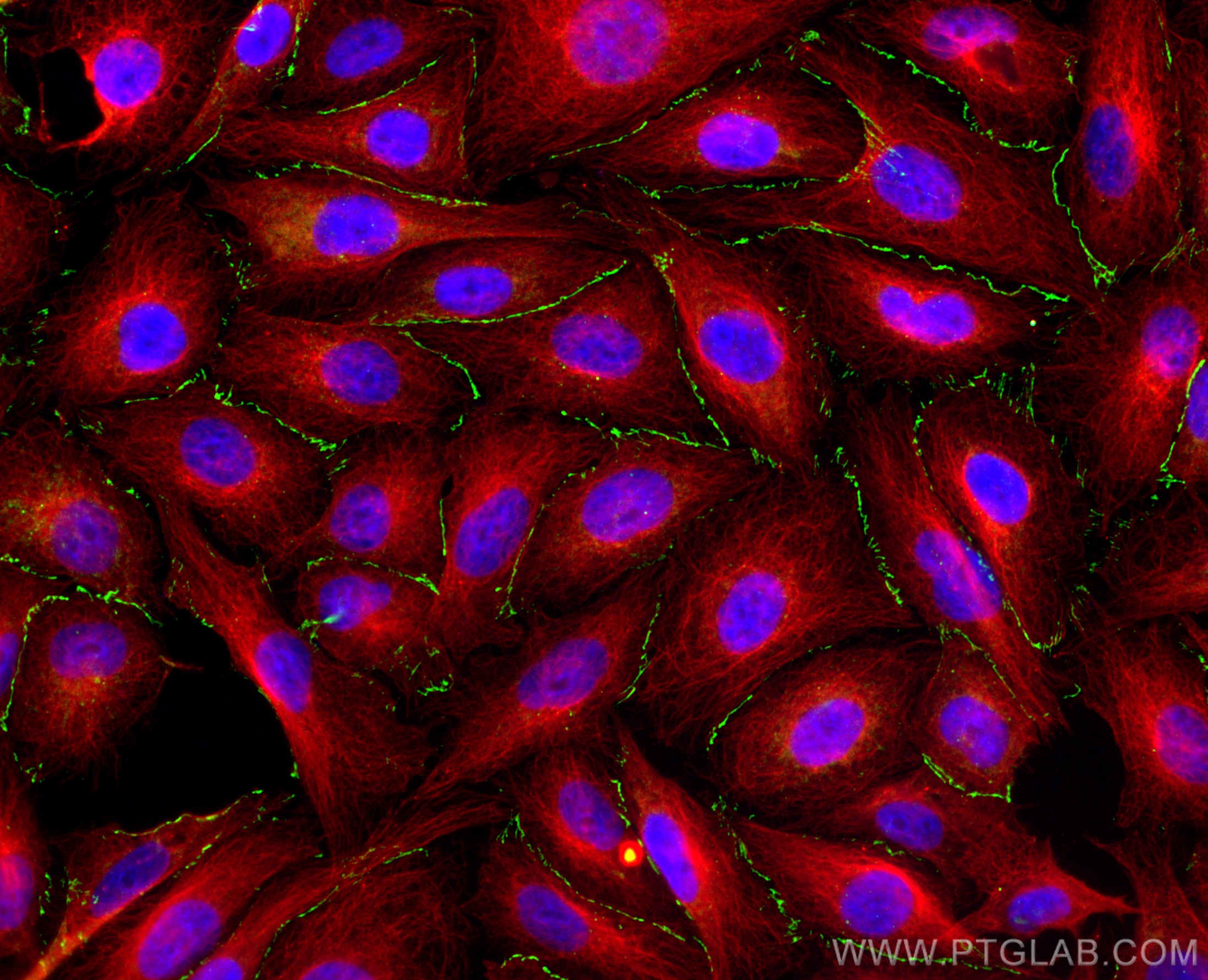 IF Staining of HUVEC using 21773-1-AP