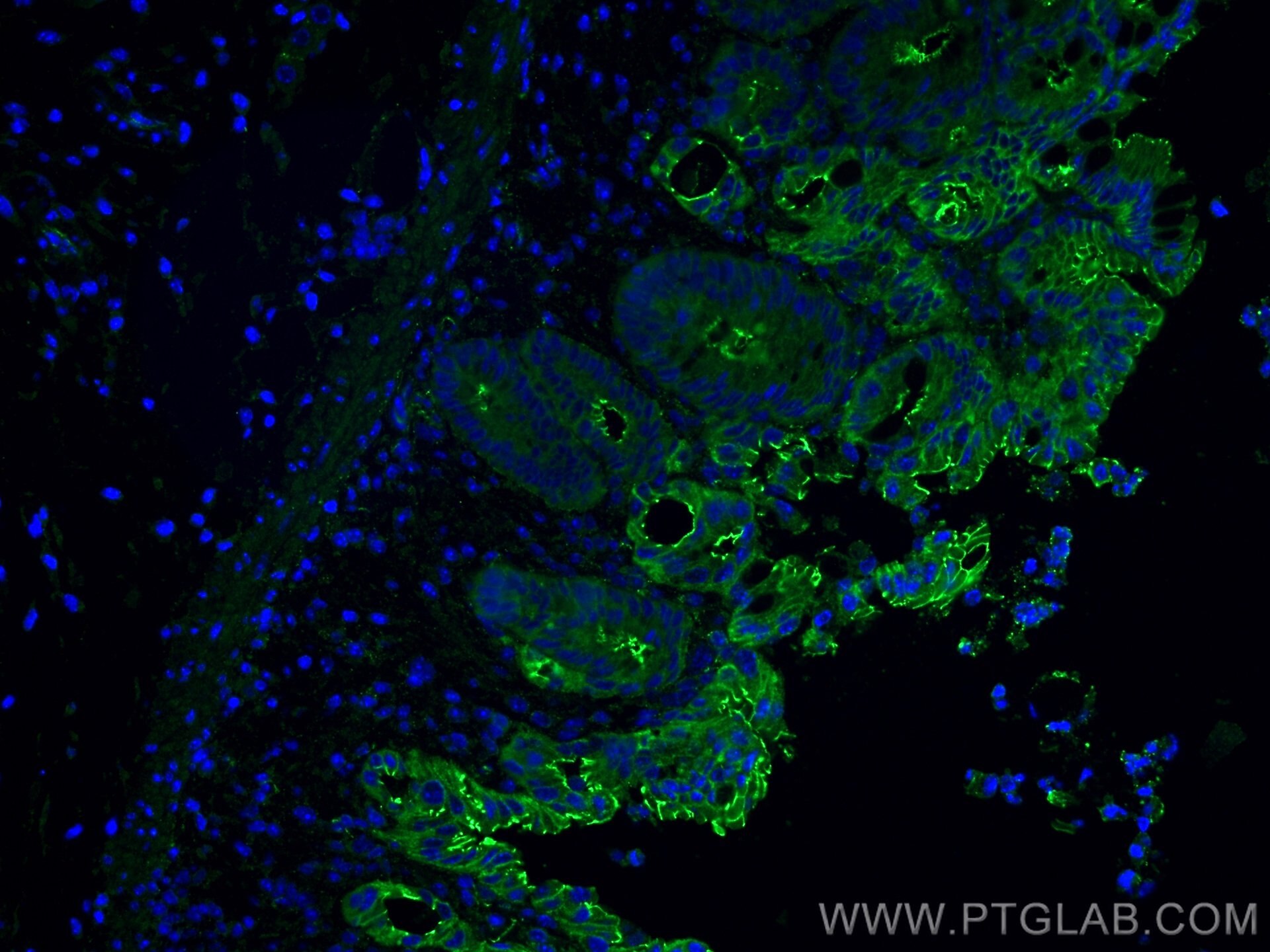 Immunofluorescence (IF) / fluorescent staining of mouse colon tissue using ZO-1 Polyclonal antibody (21773-1-AP)