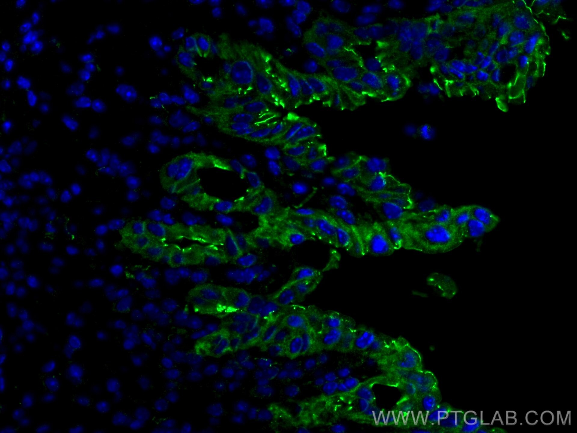 Immunofluorescence (IF) / fluorescent staining of mouse colon tissue using ZO-1 Polyclonal antibody (21773-1-AP)