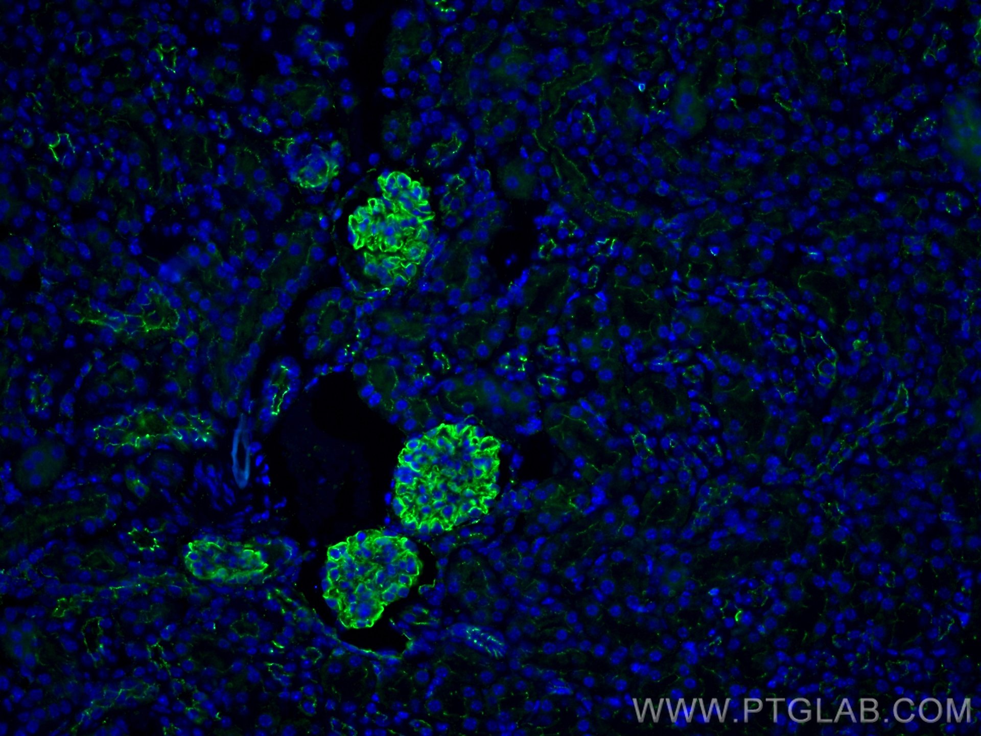 Immunofluorescence (IF) / fluorescent staining of mouse kidney tissue using ZO-1 Polyclonal antibody (21773-1-AP)
