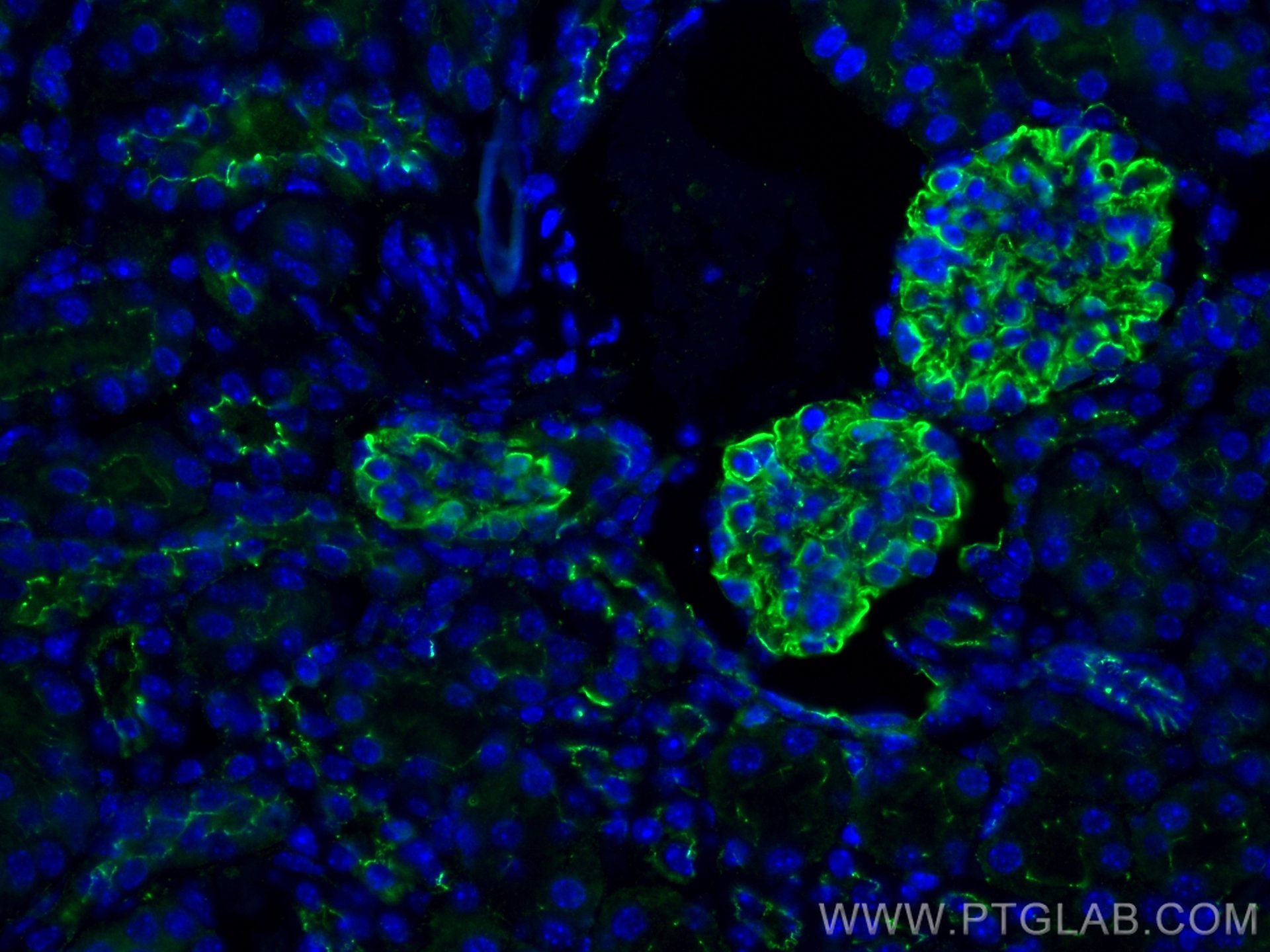 IF Staining of mouse kidney using 21773-1-AP
