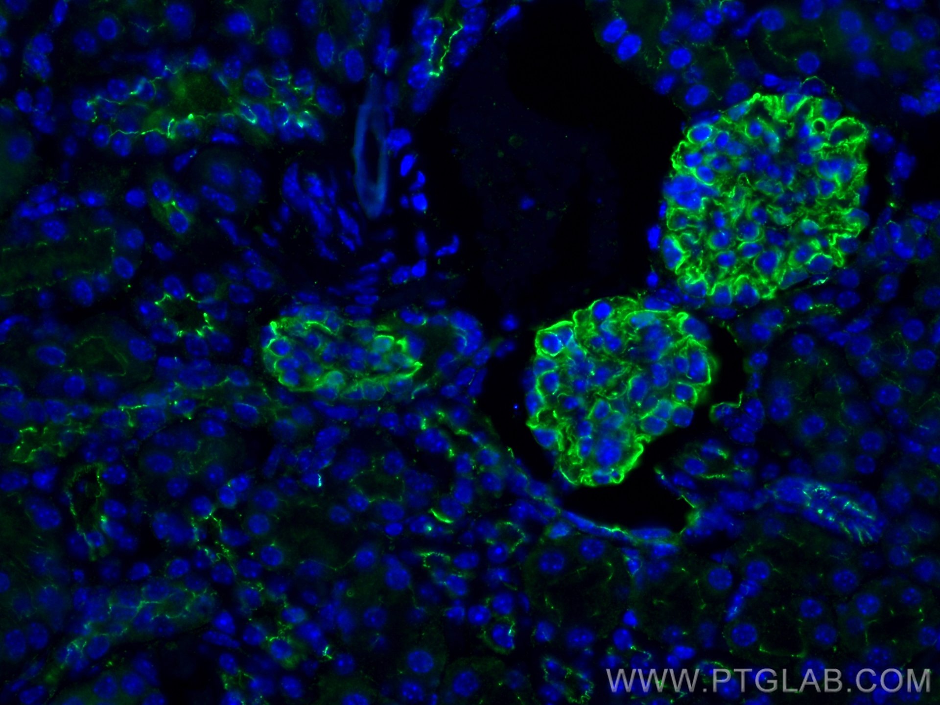 Immunofluorescence (IF) / fluorescent staining of mouse kidney tissue using ZO-1 Polyclonal antibody (21773-1-AP)