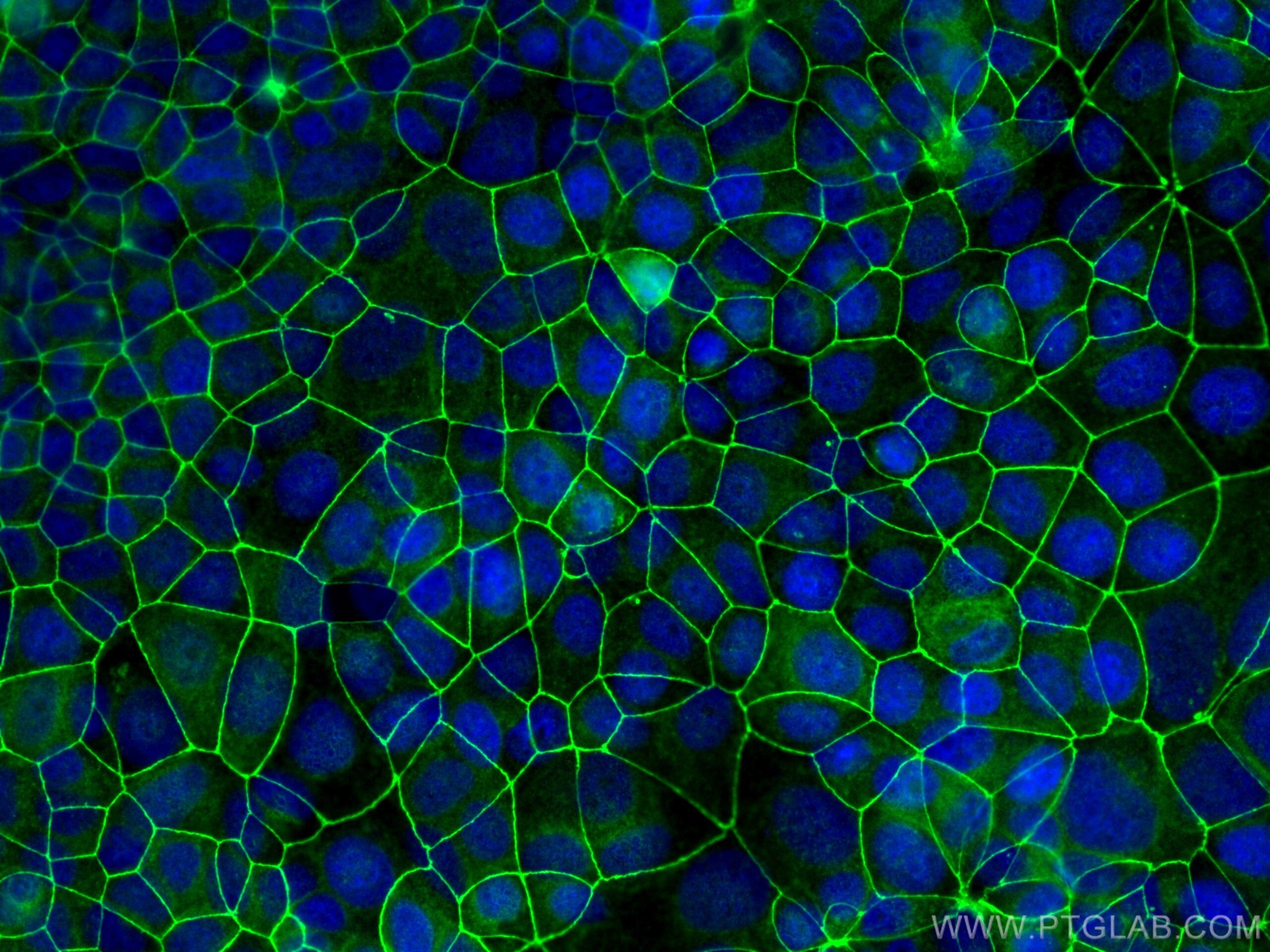 Immunofluorescence (IF) / fluorescent staining of MCF-7 cells using ZO-1 Polyclonal antibody (21773-1-AP)