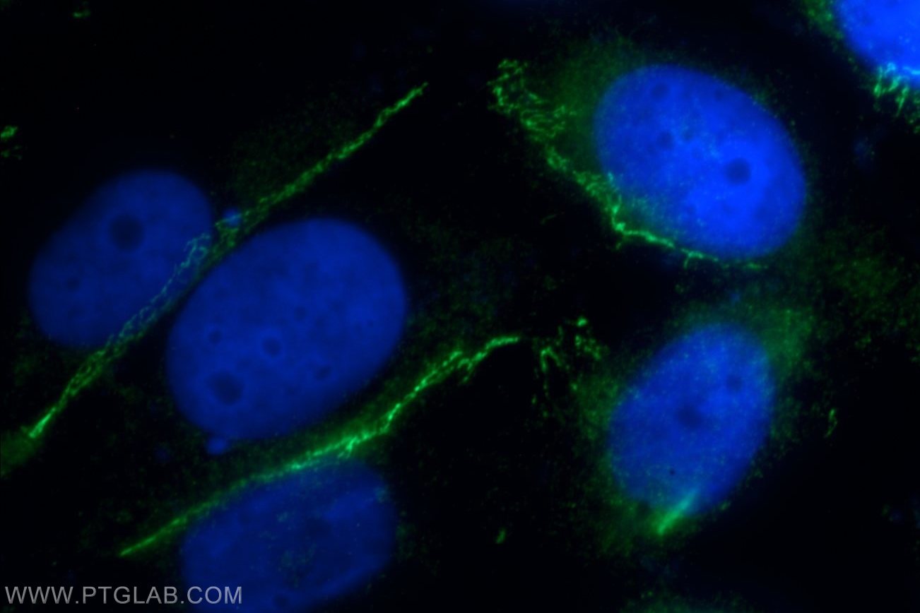 ZO-1 Polyclonal antibody