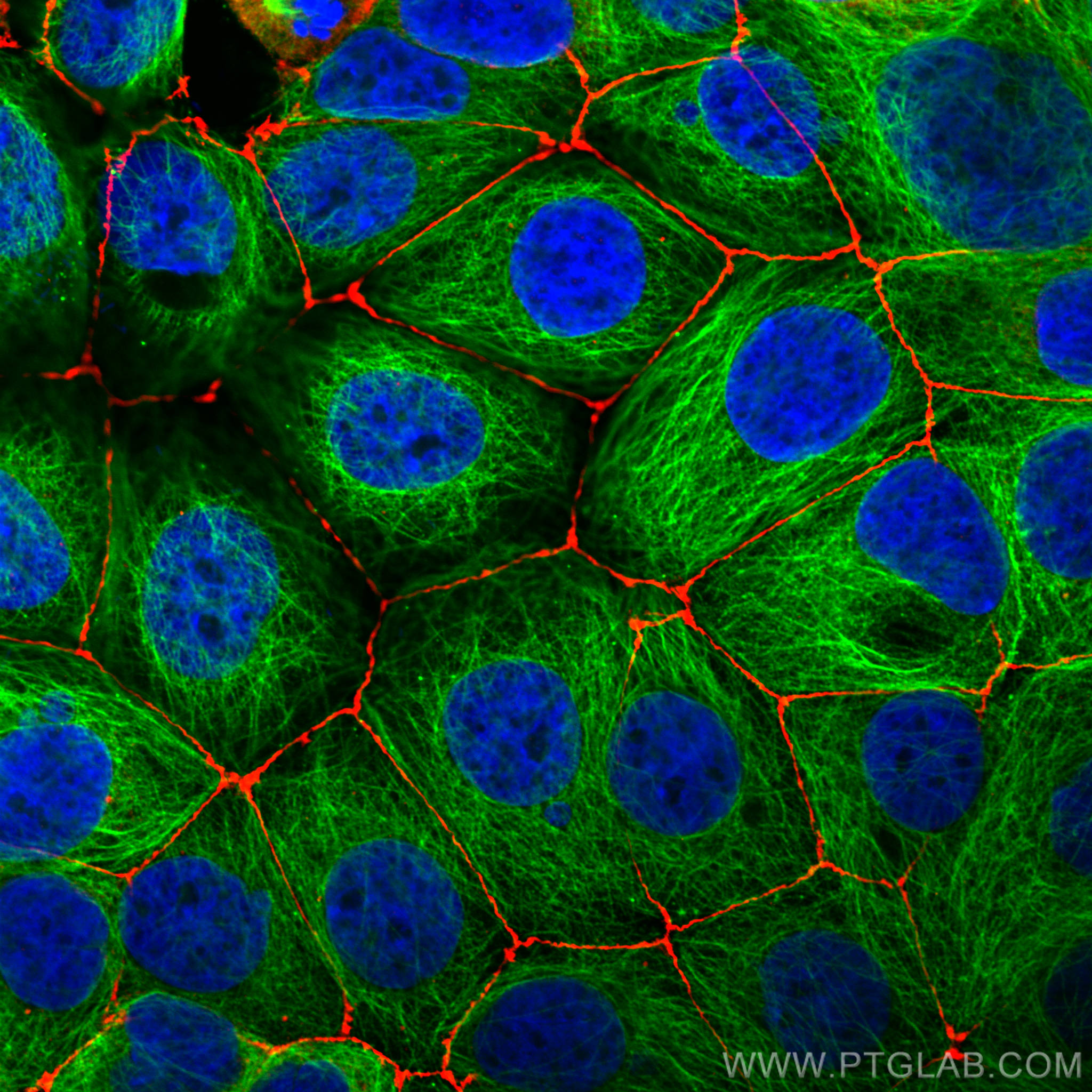 Immunofluorescence (IF) / fluorescent staining of MCF-7 cells using ZO-1 Polyclonal antibody (21773-1-AP)
