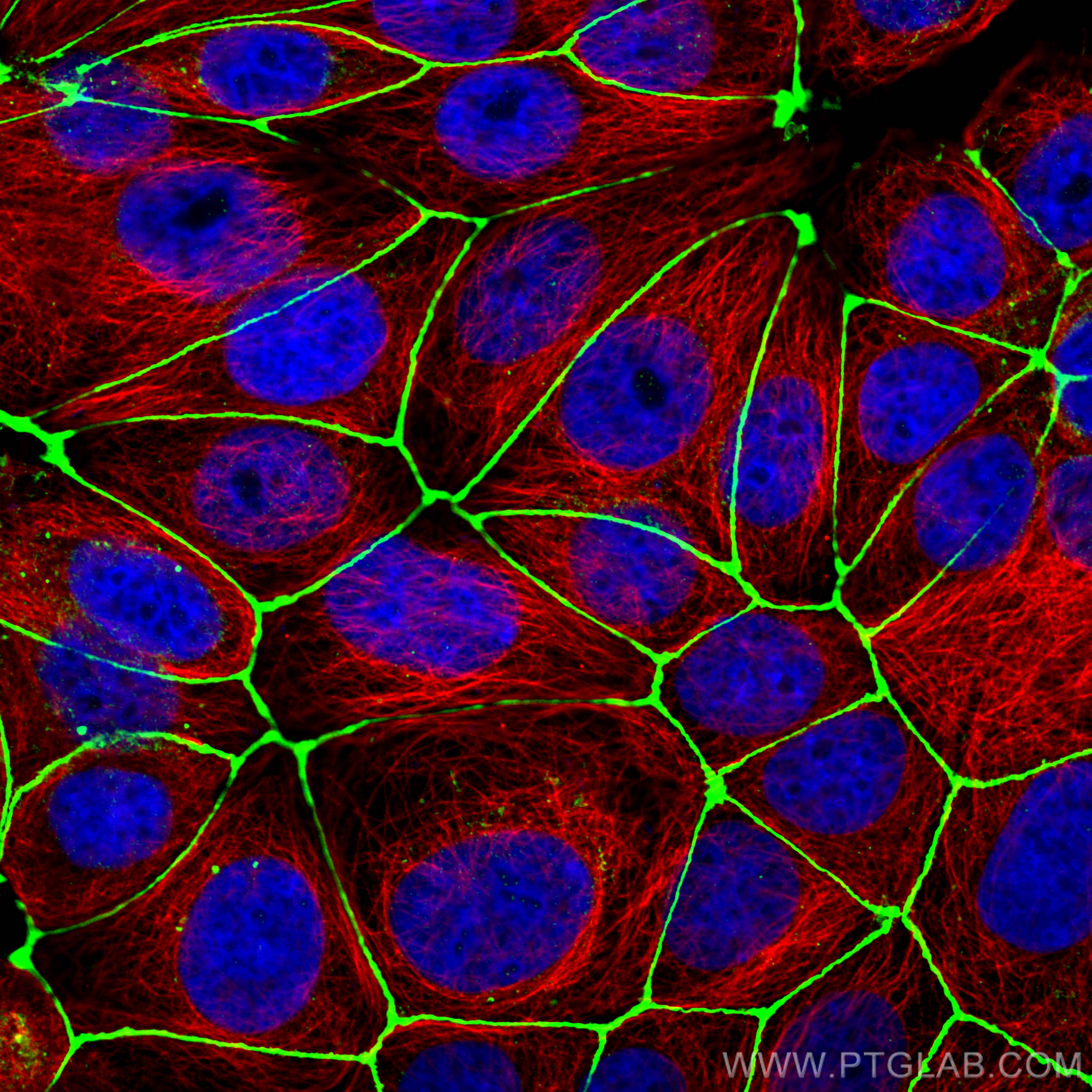 Immunofluorescence (IF) / fluorescent staining of MCF-7 cells using ZO-1 Polyclonal antibody (21773-1-AP)