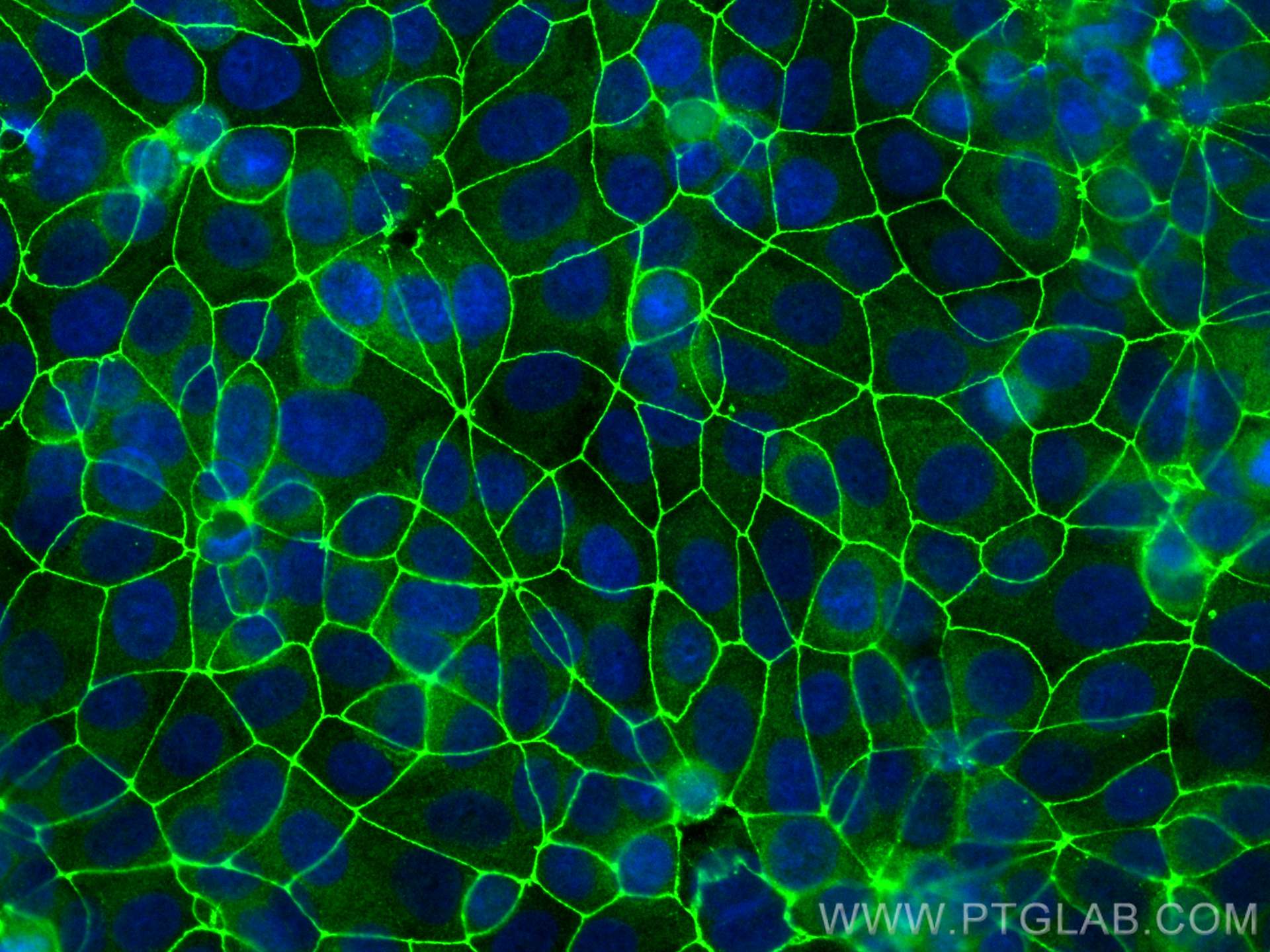 Immunofluorescence (IF) / fluorescent staining of MCF-7 cells using ZO-1 Polyclonal antibody (21773-1-AP)