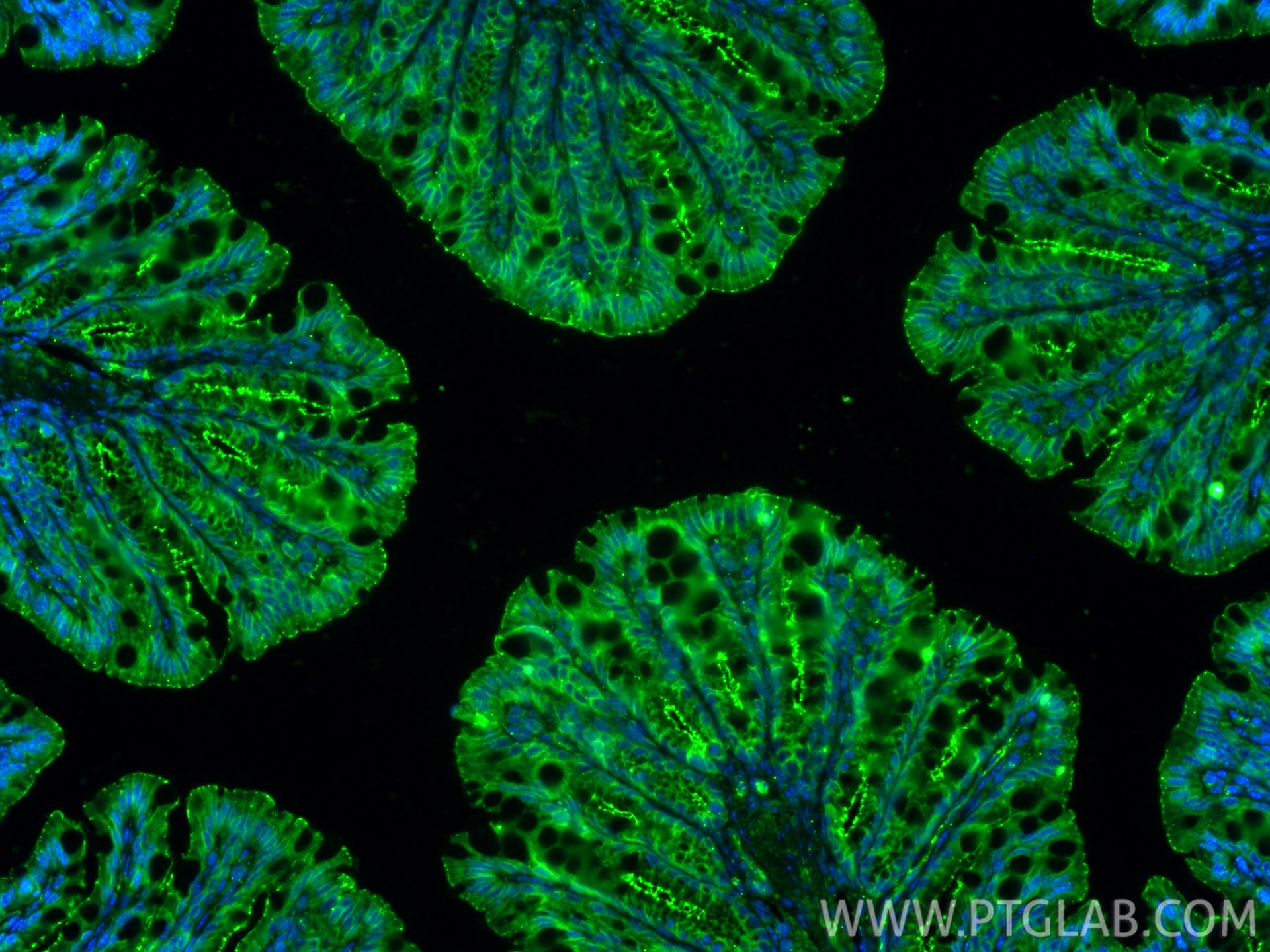 IF Staining of mouse colon using 21773-1-AP Immunofluorescence (IF) / fluorescent staining of mouse colon tissue using ZO-1 Polyclonal antibody (21773-1-AP)
