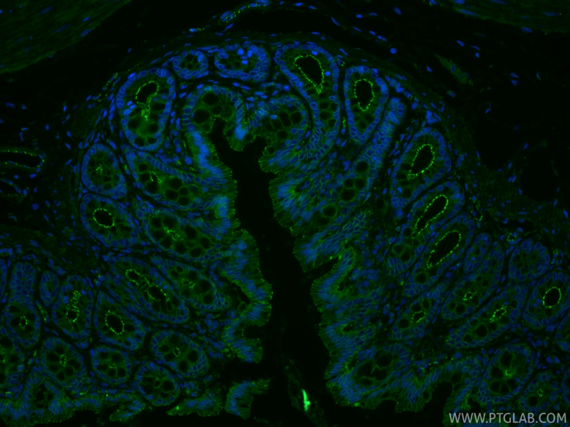 Immunofluorescence (IF) / fluorescent staining of rat colon tissue using ZO-1 Polyclonal antibody (21773-1-AP)