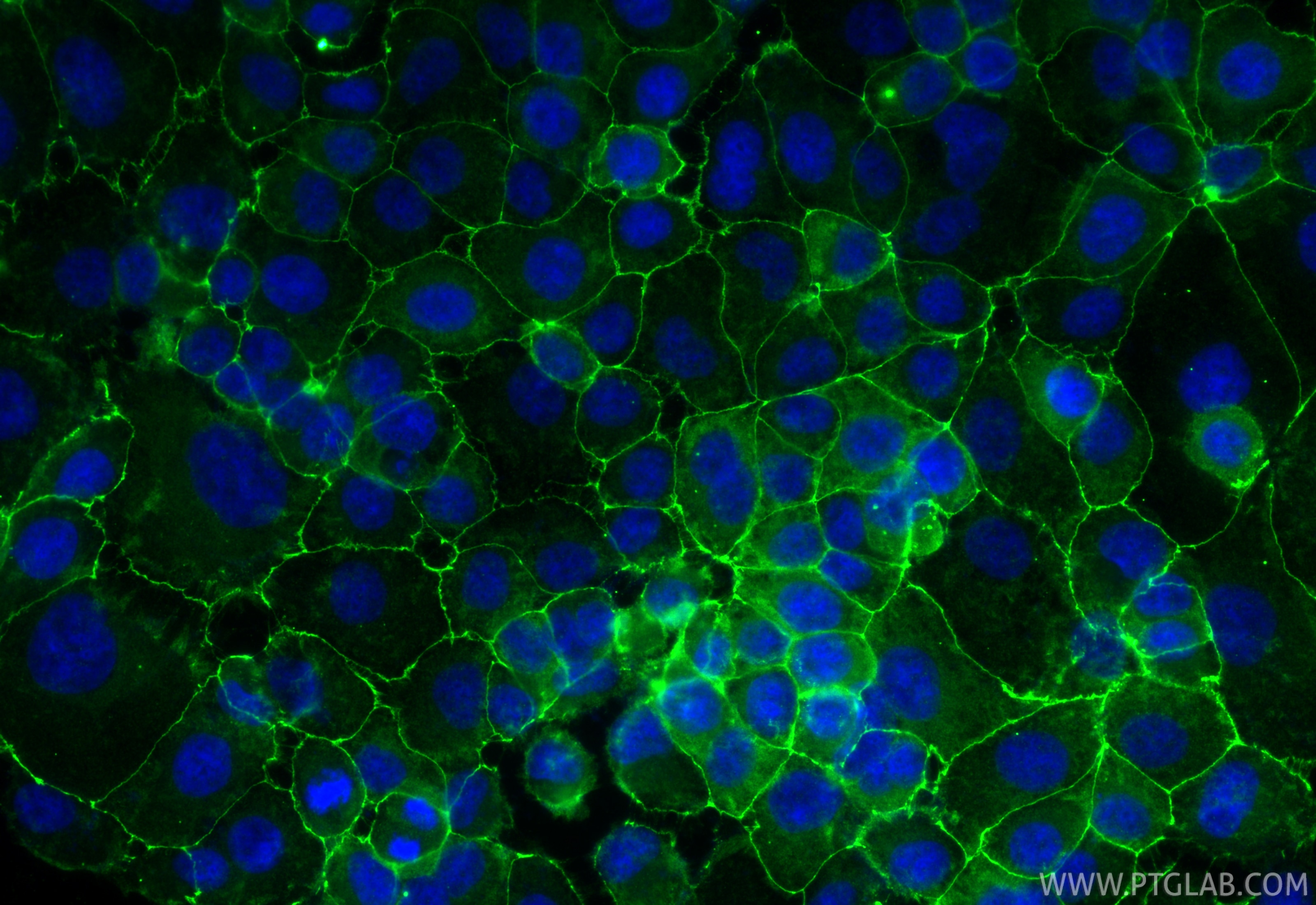 Immunofluorescence (IF) / fluorescent staining of OVCAR-3 cells using ZO-1 Polyclonal antibody (21773-1-AP)